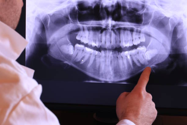 Best Emergency Dental Surgery in Cao, ND