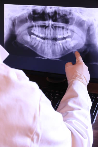 Best Emergency Broken Tooth Repair in Cao, ND